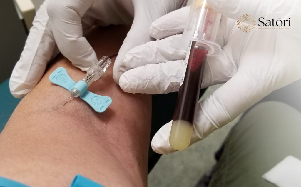 Medical professional injecting needle to draw blood into a vial.