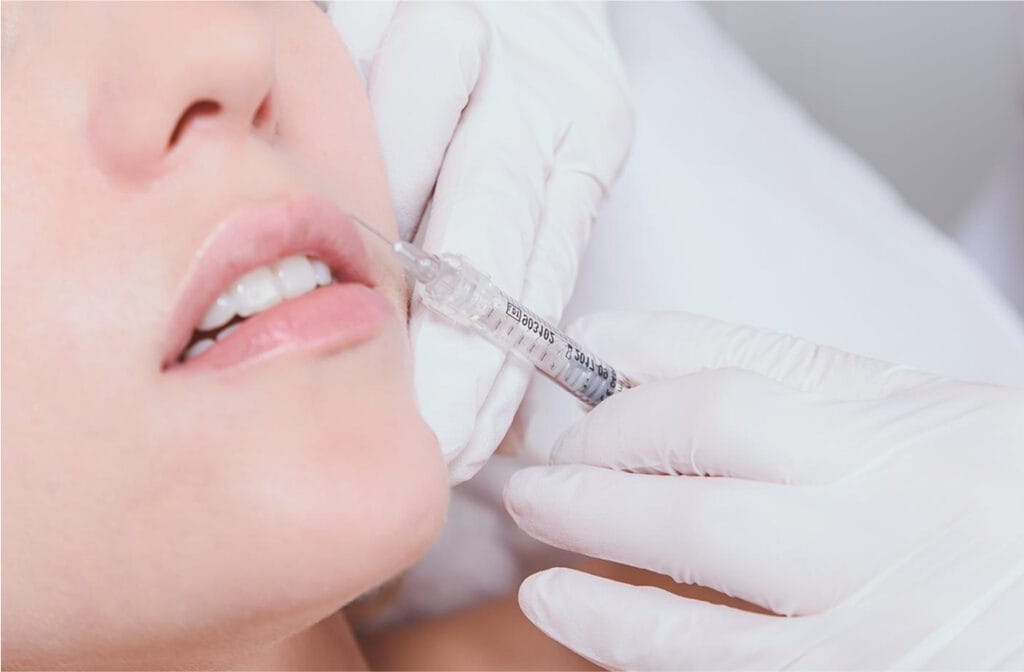 Close-up of a woman receiving a dermal filler injection to reduce facial wrinkles, highlighting the treatment process.