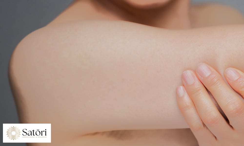 Close-up of smooth, healthy skin on a woman’s arm in her 30s.